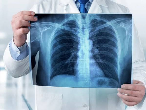 XRay Investigation