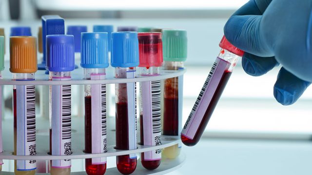1654491235-diagnostic-center-in-mumbai